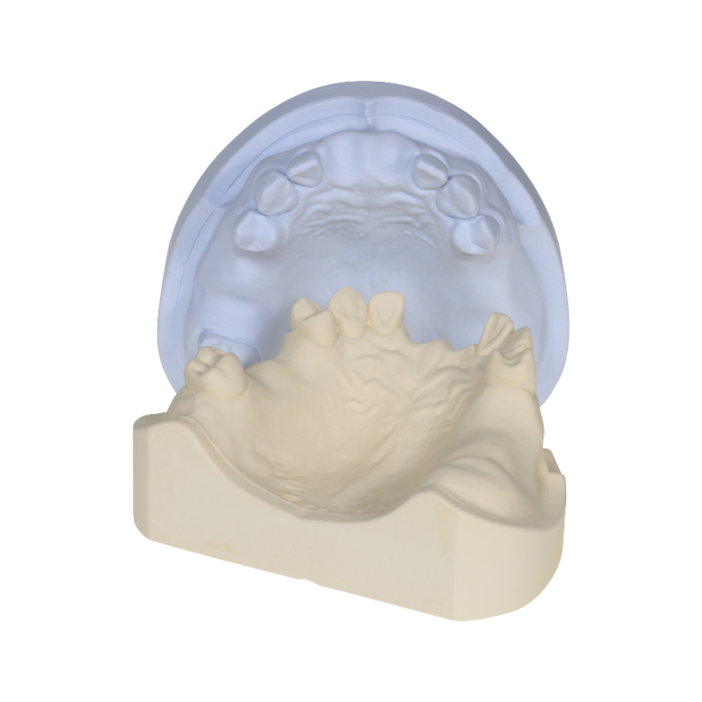 DURAPLAST GIALLO - 20 Kg